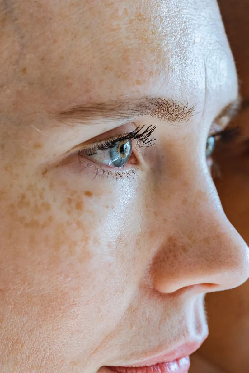 Licensed editorial close-up of natural skin and freckles
